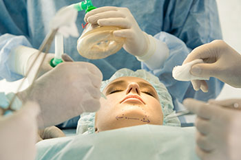 Facial Cosmetic Surgery