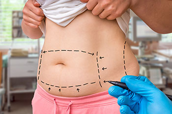 Body Contouring & Slimming Program