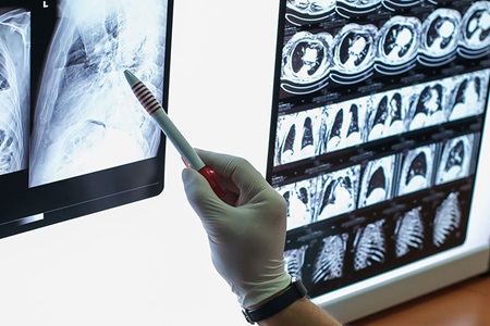 Medical professional studying x-rays